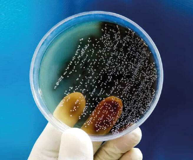 bioburden büyoyük testi