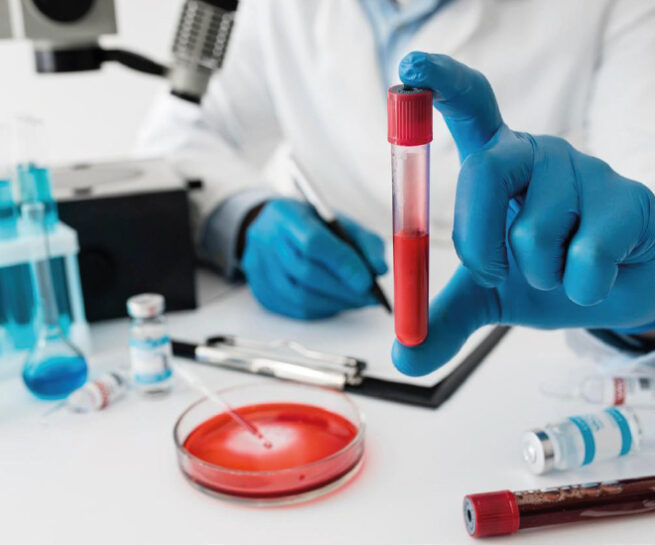 hemoliz-testi-TS EN 10993-4 testi